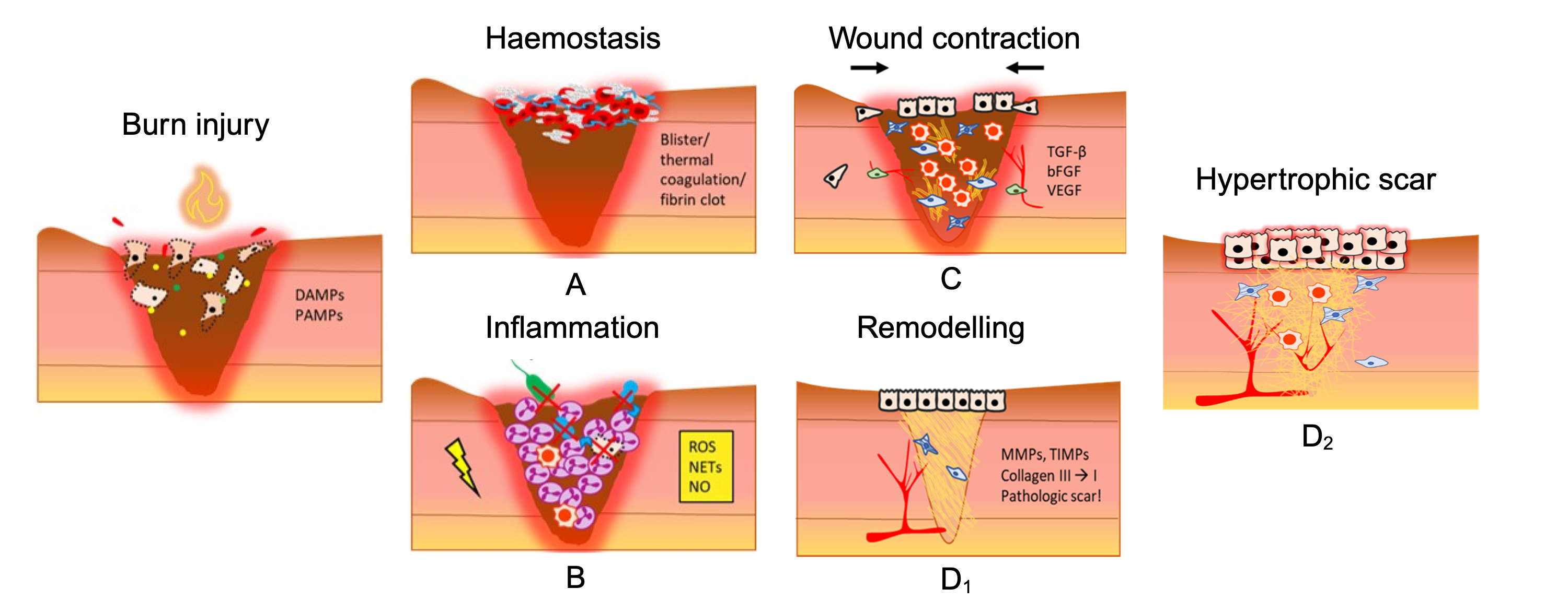 Tissue description after burn